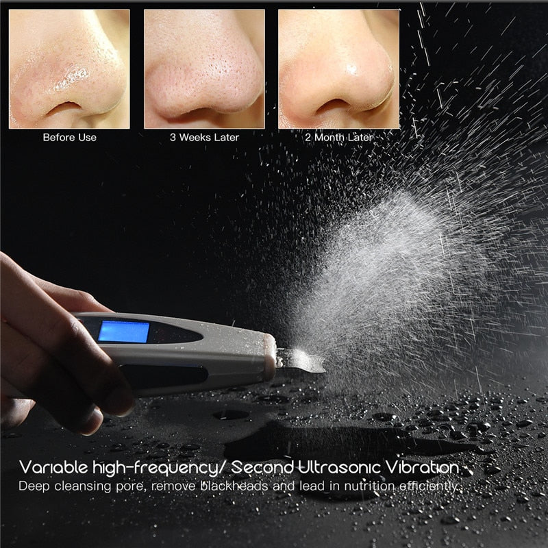 Ultrasonic Skin Scrubber Deep Face Cleaning Machine Remove Dirt